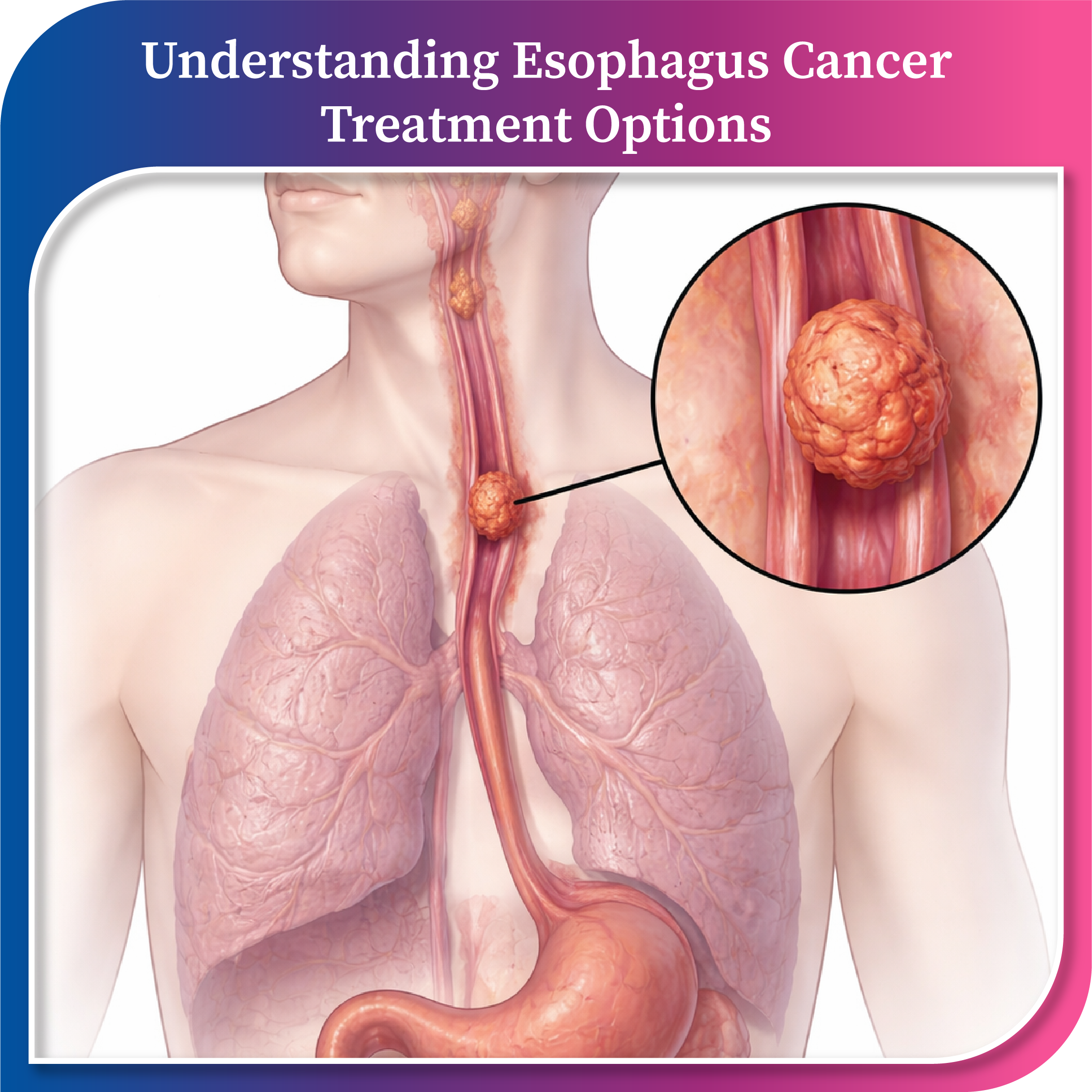Dr. Rajesh Shinde- Best Surgical Oncologist in Chembur
